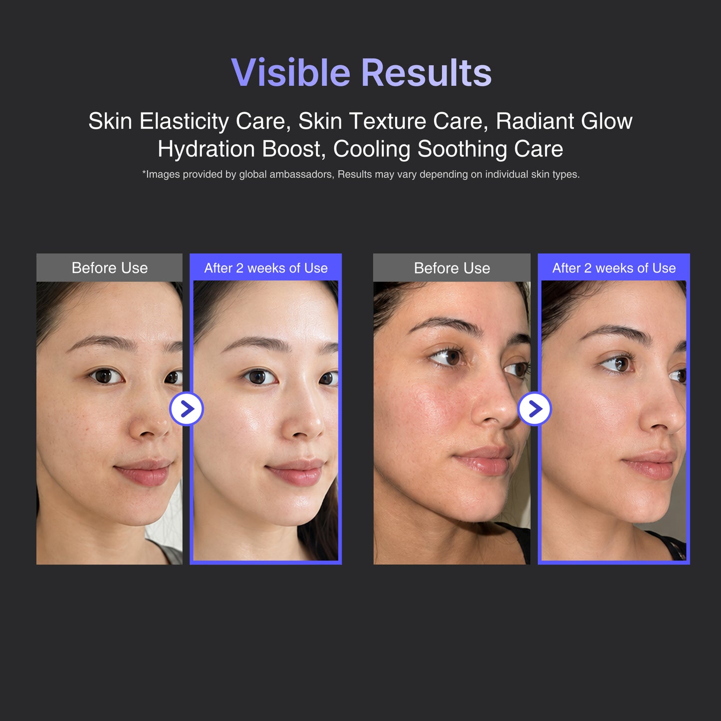 Cryo Sonic Pro with Moisture Booster Gel (100g)